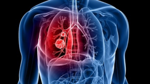 Có 12 bệnh sau nên ăn chuối thường xuyên